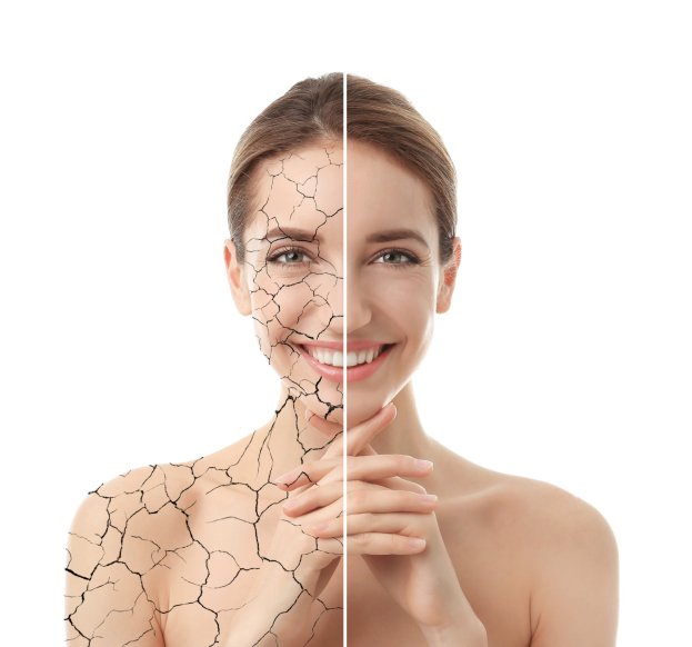 collage-with-photos-woman-having-dry-skin-problem-befo