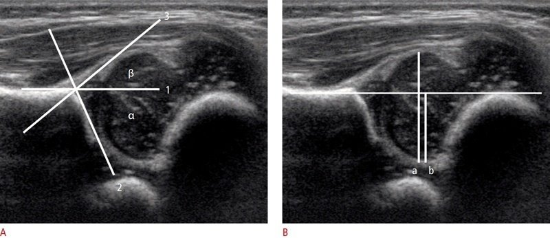 Eklem-Ultrasonografisi