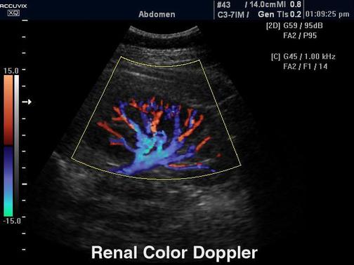 Renkli Doppler Ultrasonografi 2