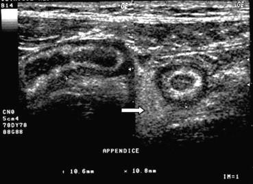 PEDAİTRİK KARIN ULTRASONU 3