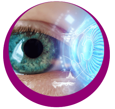 IMPLANTATION DE LENTILLE