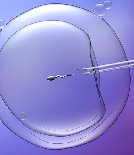 TANDEM IVF