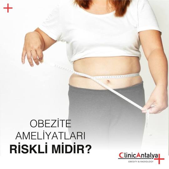 Obezite Ameliyatları Riskli midir