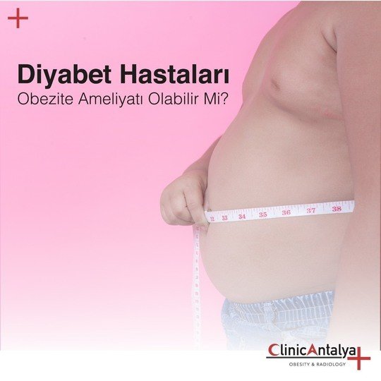 Diyabet Hastaları Obezite Ameliyatı Olabilir mi