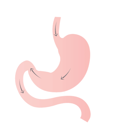 Stomach_clinicantalya