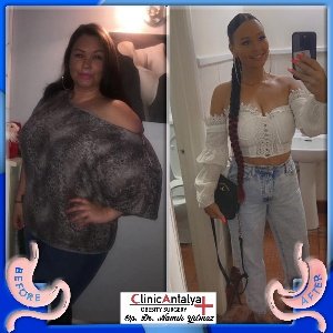 433611452_18223208185276771_4796589208712078421_N