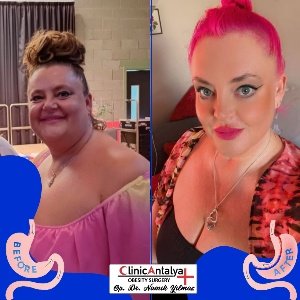 460829539_18245471137276771_7339966095045462415_N