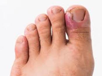 Sivas Solaryum - Marvel Güzellik Merkezi