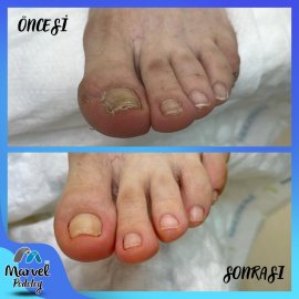 Medikal Ayak Bakımı