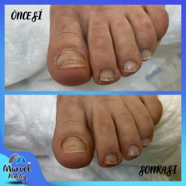 Medikal Ayak Bakımı