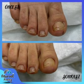 Medikal Ayak Bakımı