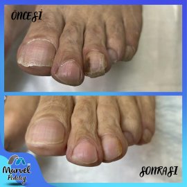 Medikal Ayak Bakımı