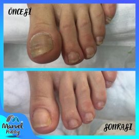 Medikal Ayak Bakımı