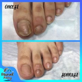 Medikal Ayak Bakımı