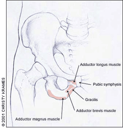 osteitis3