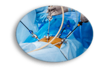laparoscopic
