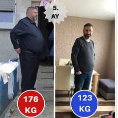 Adipositaschirurgie / Clinic Antalya in der Türkei