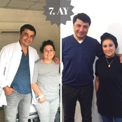 Adipositaschirurgie / Clinic Antalya in der Türkei