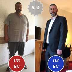 Adipositaschirurgie / Clinic Antalya in der Türkei