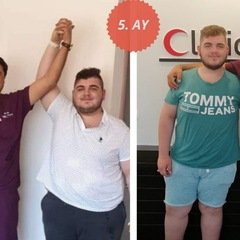 Adipositaschirurgie / Clinic Antalya in der Türkei