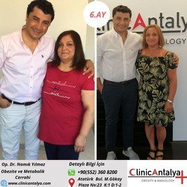 Adipositaschirurgie / Clinic Antalya in der Türkei
