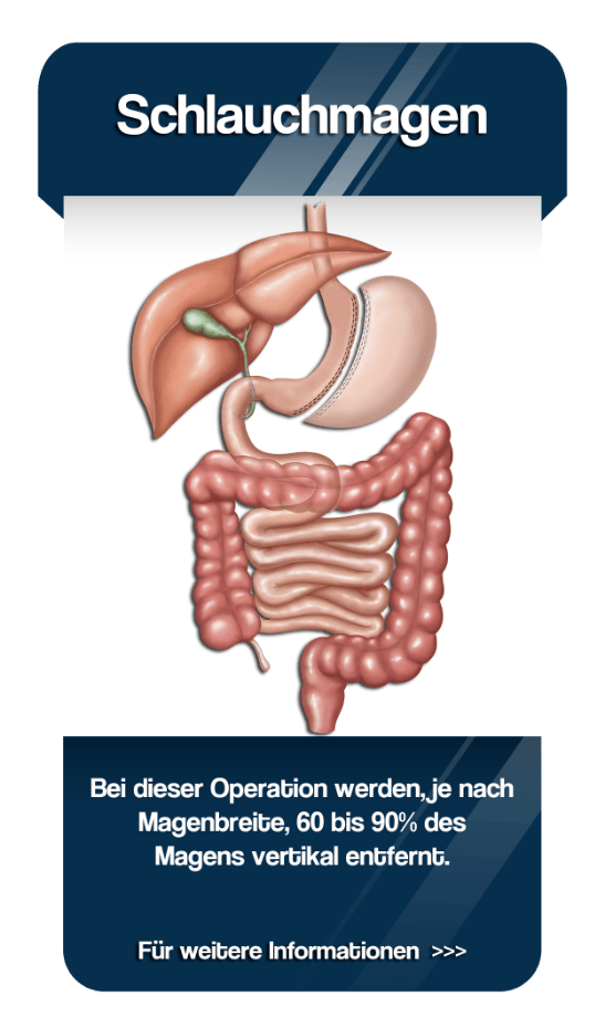 Web_home_Schlauchmagen
