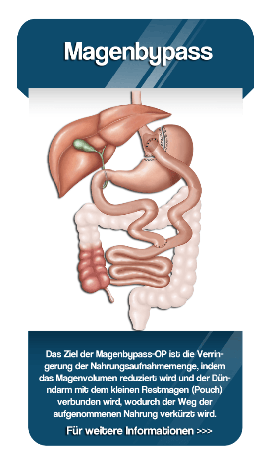 Web_home_Magenbypass