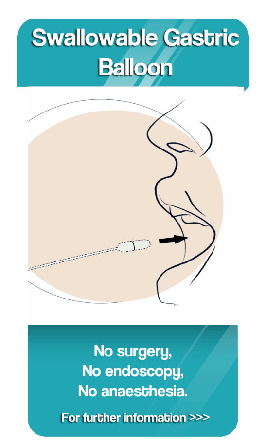 Swallowable Gastric Balloon - home page category