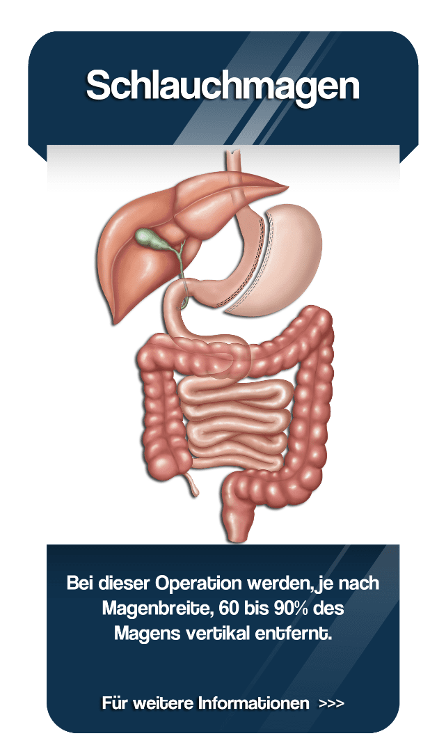 Web_Home_Schlauchmagen