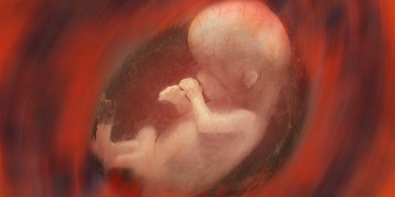 HLA(组织相容性兄弟姐妹)