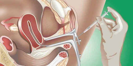 Aşılama bebek nasıl olur