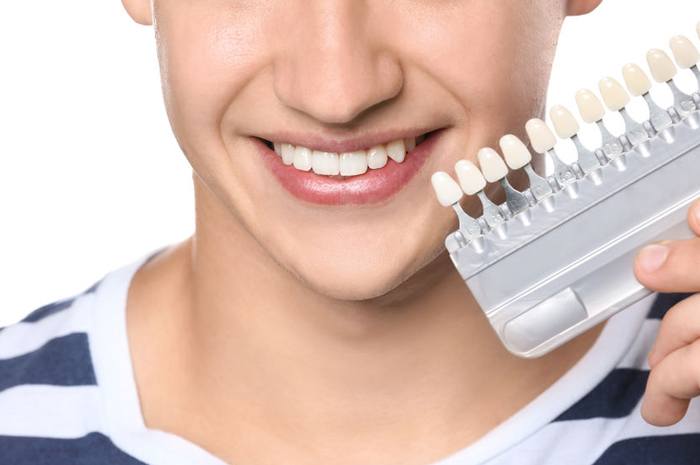 Zahnkronen-und-Porzellan-Kronen