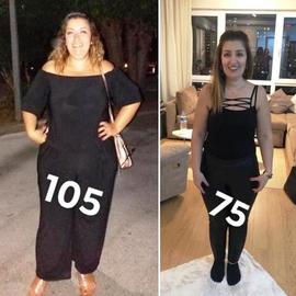 VORHER NACHER BILDER DER PATIENTEN