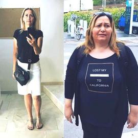 VORHER NACHER BILDER DER PATIENTEN