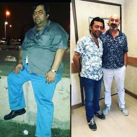 VORHER NACHER BILDER DER PATIENTEN