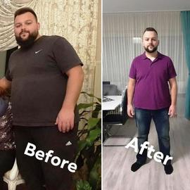 VORHER NACHER BILDER DER PATIENTEN