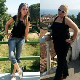 VORHER NACHER BILDER DER PATIENTEN