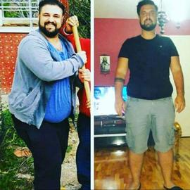 VORHER NACHER BILDER DER PATIENTEN