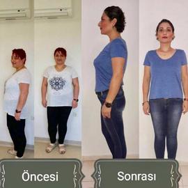 VORHER NACHER BILDER DER PATIENTEN