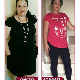 VORHER NACHER BILDER DER PATIENTEN