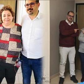 VORHER NACHER BILDER DER PATIENTEN