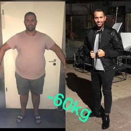 VORHER NACHER BILDER DER PATIENTEN