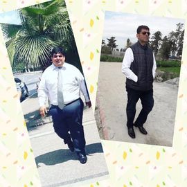 VORHER NACHER BILDER DER PATIENTEN