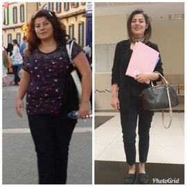 VORHER NACHER BILDER DER PATIENTEN