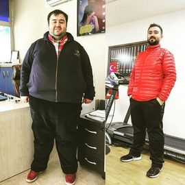 VORHER NACHER BILDER DER PATIENTEN