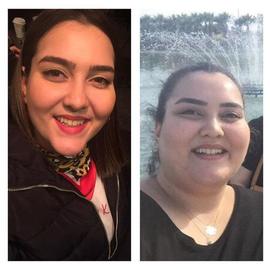 VORHER NACHER BILDER DER PATIENTEN