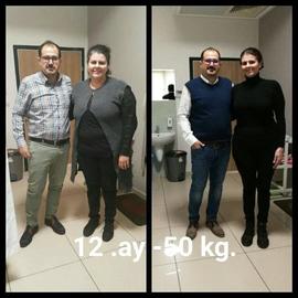 VORHER NACHER BILDER DER PATIENTEN