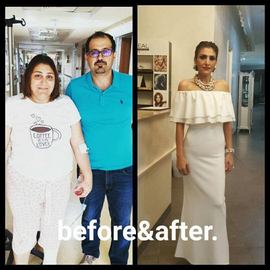 VORHER NACHER BILDER DER PATIENTEN