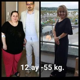 VORHER NACHER BILDER DER PATIENTEN