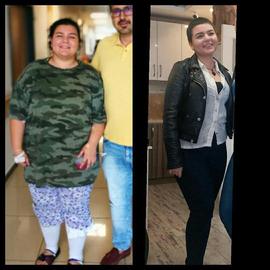 VORHER NACHER BILDER DER PATIENTEN